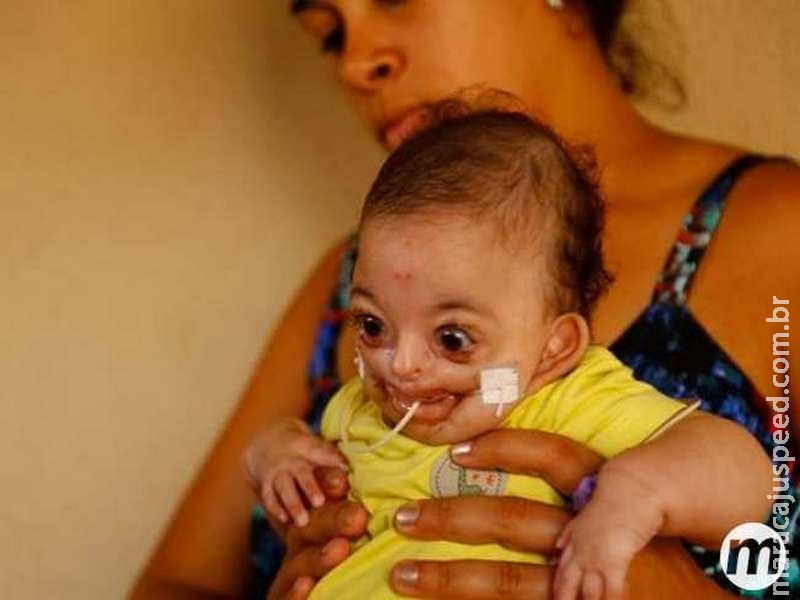 Família de bebê com síndrome rara faz almoço para bancar tratamento Família de bebê com síndrome rara faz almoço para bancar tratamento