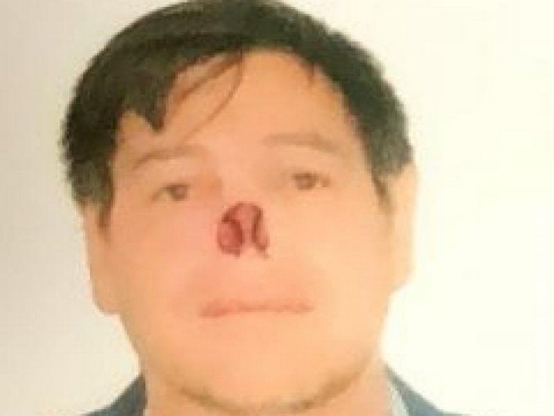 Pistoleiro suspeito de matar policial civil de MS é preso na fronteira