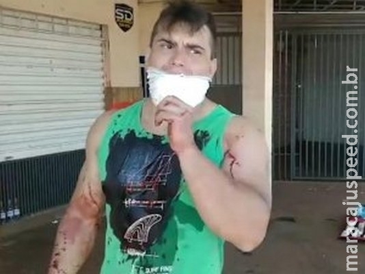 Ciclista é baleado em atentado perto de condomínio na Capital