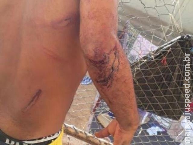 Presos feridos em confronto com o Choque passarão por corpo de delito