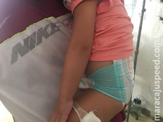 De cada 10 crianças internadas em hospital, 4 se acidentaram em casa De cada 10 crianças internadas em hospital, 4 se acidentaram em casa