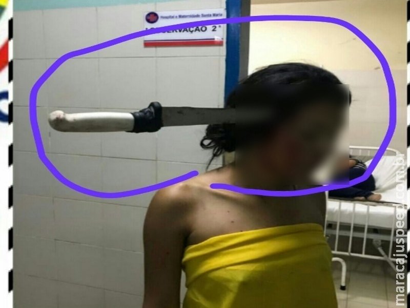 Briga de irmãos termina com faca cravada na cabeça de jovem adolescente