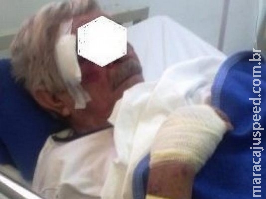 Idoso de 73 anos é agredido a pauladas por PM e outra duas pessoas