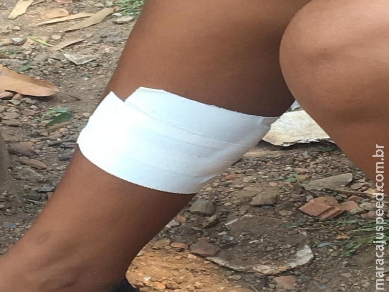 Jovem de 17 anos é esfaqueada na perna por namorado ciumento em MS