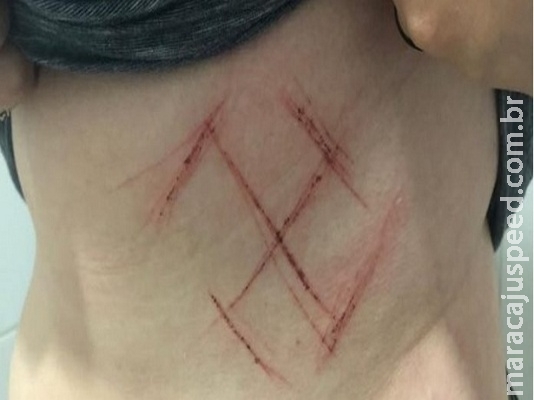 Jovem marcada com suástica no RS será indiciada por falso testemunho