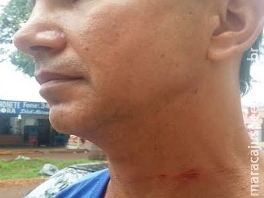 Motociclista tem pescoço ferido por linha chilena Motociclista tem pescoço ferido por linha chilena