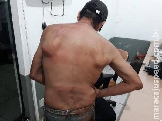 Mulher e atual namorado são agredidos a facadas e pauladas pelo ex