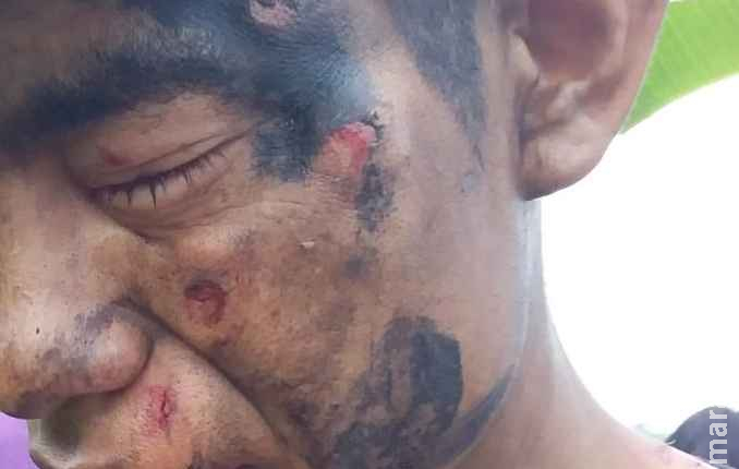  Ao menos 19 índios ficaram feridos em quatro ataques à reserva da tribo Kaiowá em MS