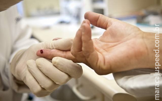 Mato Grosso do Sul está entre os estados com aumento de óbitos por AIDS