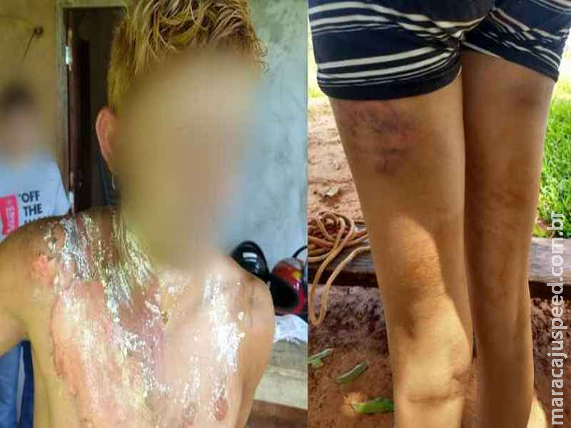 Mulher sequestrada e estuprada pelo ex queima homem para se livrar de torturas