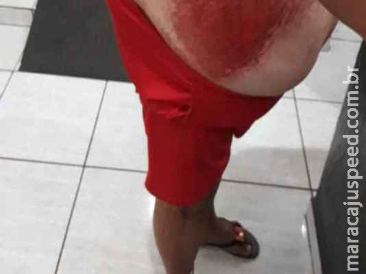 Passou com o carro por cima de mulher por causa de dívida de R$ 1 mil