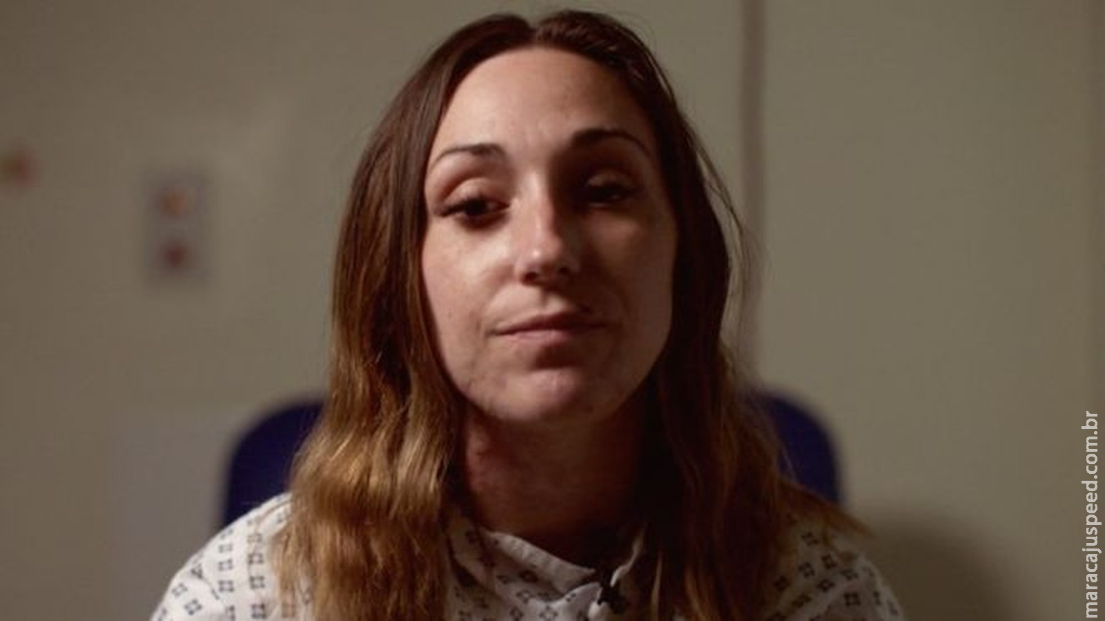 Por dentro de um hospital que cuida de vítimas de ataques com ácido Por dentro de um hospital que cuida de vítimas de ataques com ácido