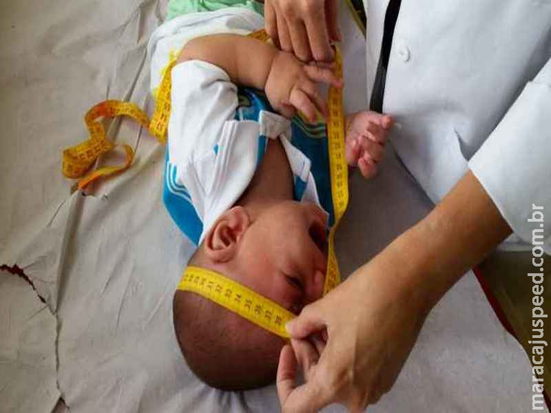 Três anos após surto, mães de bebês com microcefalia vivem novos desafios Três anos após surto, mães de bebês com microcefalia vivem novos desafios