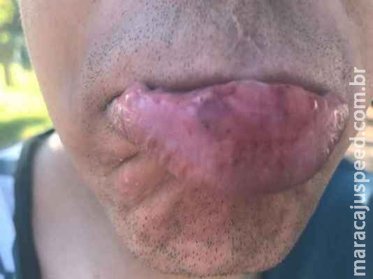 Balada termina com mordida na boca, denúncia de assédio e pai preso