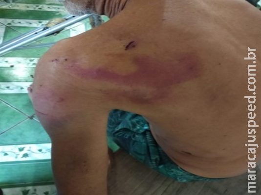  Bandidos amarram taxista no porta-malas, invadem casas e espancam idoso com perna quebrada