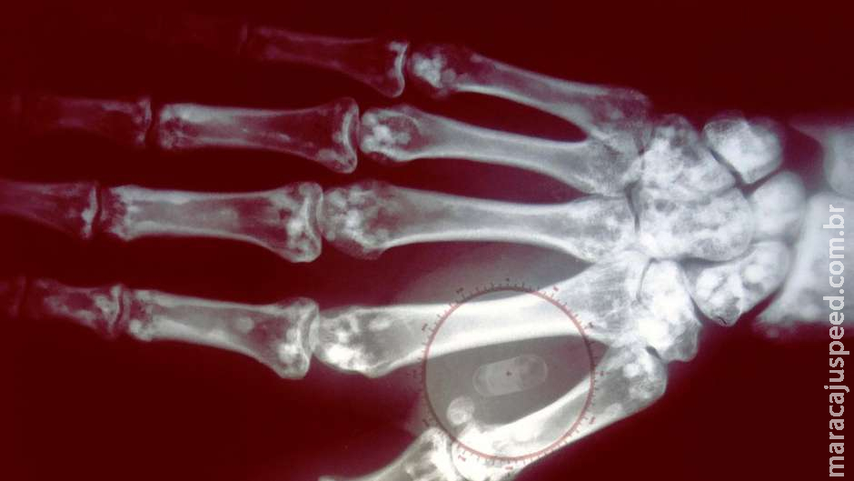 Como funcionam os microchips implantados sob a pele que permitem pagar sem dinheiro ou cartão Como funcionam os microchips implantados sob a pele que permitem pagar sem dinheiro ou cartão