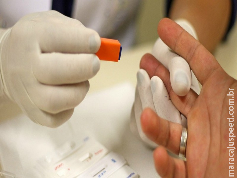SUS distribuirá autotestes de HIV a partir de 2019