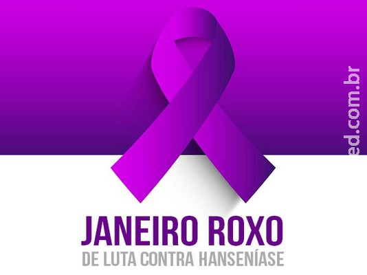 Conheça mais sobre os sinais e sintomas da Hanseníase Conheça mais sobre os sinais e sintomas da Hanseníase