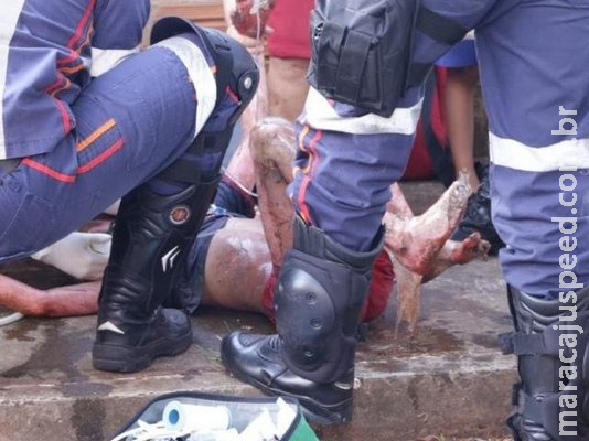 Criança de 8 anos é socorrida em estado grave após casa pegar fogo