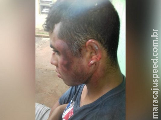 Espancado por ciúmes, jovem diz que escapou da morte graças aos vizinhos