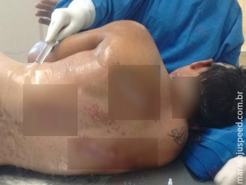 Serralheiro que levou choque 270 vezes maior que voltagem da tomada trabalha com Serralheiro que levou choque 270 vezes maior que voltagem da tomada trabalha com