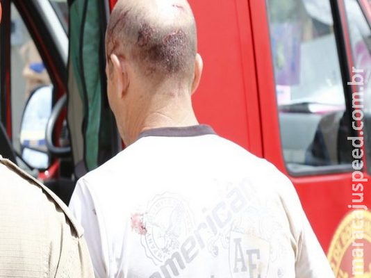 Homem encosta em fio de alta tensão, tem queimaduras e é encaminhado à Santa Casa Homem encosta em fio de alta tensão, tem queimaduras e é encaminhado à Santa Casa