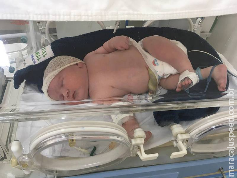 Nasce bebê de quase 6 quilos na maternidade do Hospital Regional de Ponta Porã Nasce bebê de quase 6 quilos na maternidade do Hospital Regional de Ponta Porã