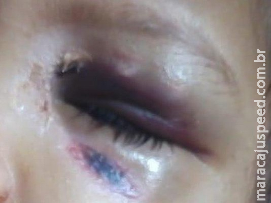 Polícia investiga tio por espancar crianças que apanhavam de madrasta