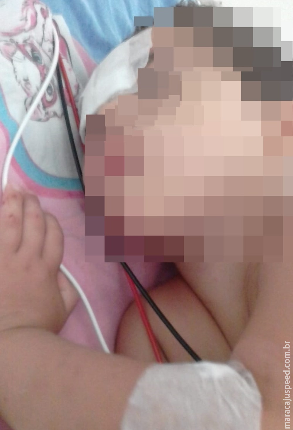 Criança de 4 anos cai em poço de cinco metros de profundidade Criança de 4 anos cai em poço de cinco metros de profundidade
