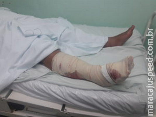 Marido mata Pit bull a marteladas depois de cachorro atacar esposa