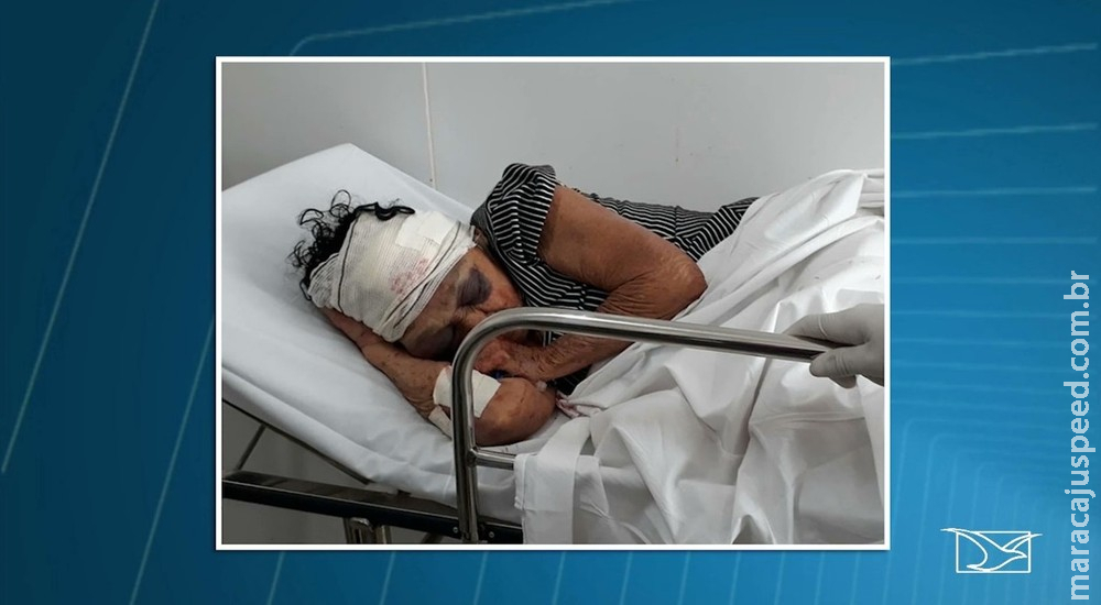 Após assalto, idosa de 81 anos espancada por bandidos morre Após assalto, idosa de 81 anos espancada por bandidos morre
