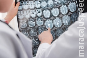 Estudo revela criação de novos neurônios até os 90 anos Estudo revela criação de novos neurônios até os 90 anos