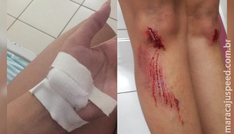  Gestante cai em buraco e reclama de falta de sinalização em obras no Centro 
