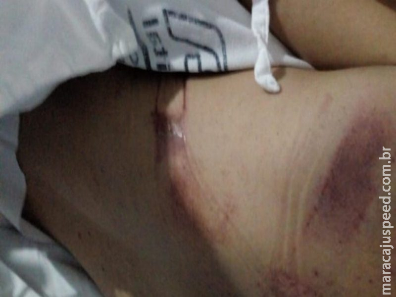 Homem é encontrado nu na rua depois de ser espancado por desconhecidos 