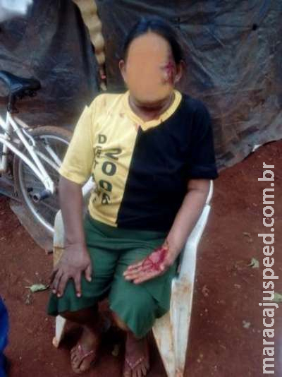 Homem é preso após espancar a mãe com pauladas em Dourados