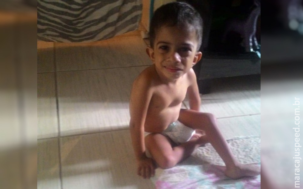 Mãe pede ajuda para filho de 4 anos que tem hidrocefalia e pesa apenas 5 kg Mãe pede ajuda para filho de 4 anos que tem hidrocefalia e pesa apenas 5 kg