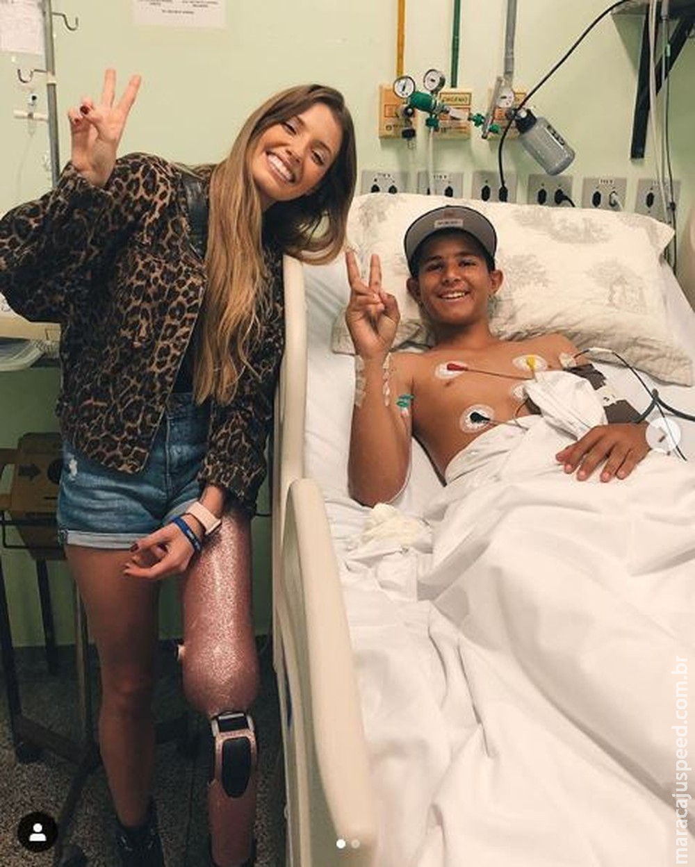 Modelo Paola Antonini visita garoto que teve perna amputada por causa de linha chilena