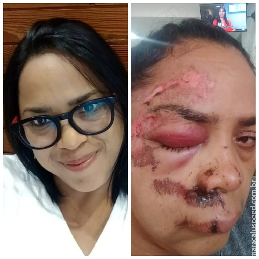 Mulher tem o rosto arrastado no asfalto por bandidos durante assalto Mulher tem o rosto arrastado no asfalto por bandidos durante assalto