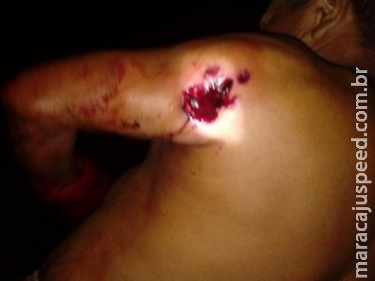 Índios acusam seguranças por ataque com ferido em área de confronto
