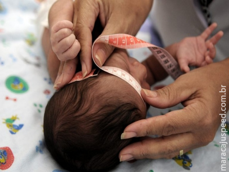 MP concede pensão vitalícia para crianças com microcefalia causada por zika