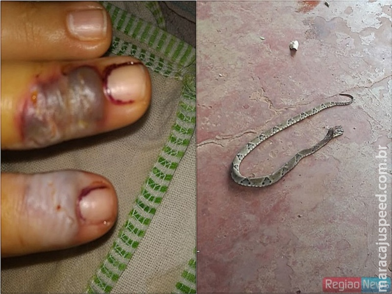 Mulher é picada por jararaca quando colhia pé de alface nos fundos de casa