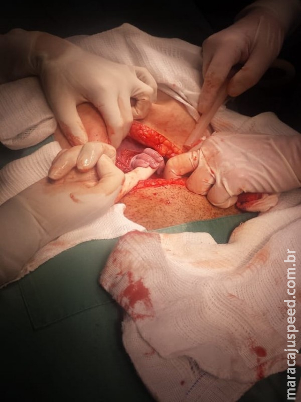 Ao abrir barriga em cesárea, bebê segura dedo de médica e emociona equipe e família: 