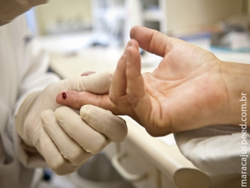 Brasil reduz em 8% casos de infecção por tuberculose e HIV Brasil reduz em 8% casos de infecção por tuberculose e HIV