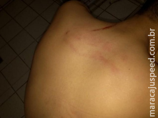 Garoto espancado por vizinho PM é transferido para cirurgia na Capital