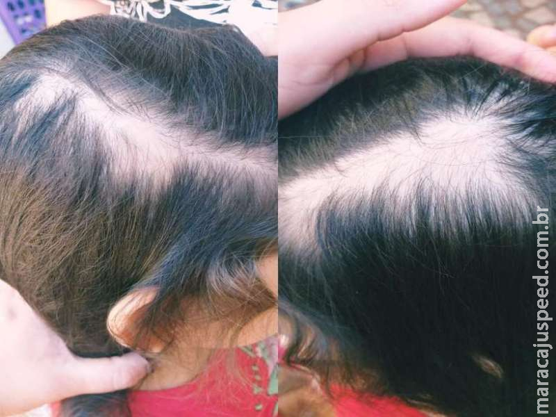 Madrasta é acusada de agredir e arrancar cabelos de menina durante festa de aniversário Madrasta é acusada de agredir e arrancar cabelos de menina durante festa de aniversário