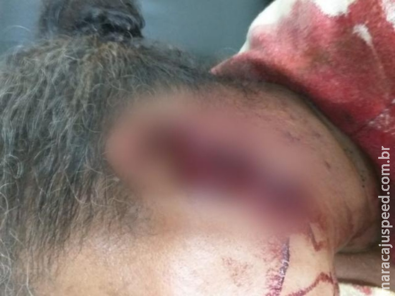 Marido é preso após cortar orelha de mulher com facão