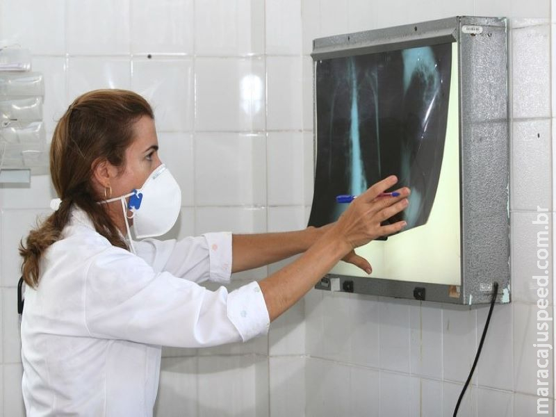 Brasil avança no combate à tuberculose