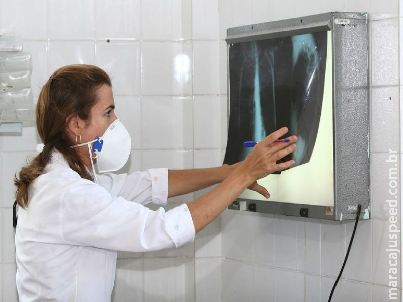 Brasil avança no combate à tuberculose Brasil avança no combate à tuberculose