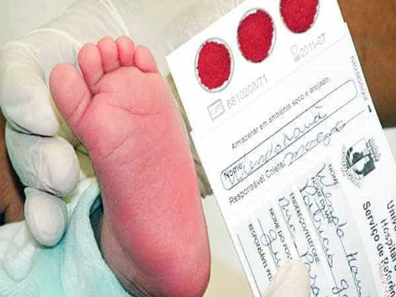 Fibrose cística é genética e mais comum na infância Fibrose cística é genética e mais comum na infância