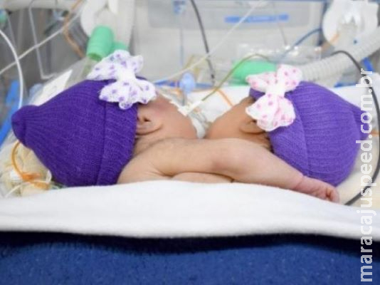 Exames "milimétricos" vão definir destino de Maria Júlia e Luna Vitória